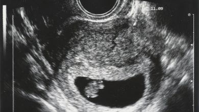 Photo de Recherche avec un modèle d'utérus – Sur la piste des mystères de l'implantation