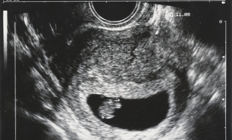 recherche-avec-un-modele-d'uterus-–-sur-la-piste-des-mysteres-de-l'implantation