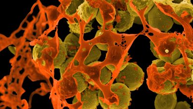 Photo de Germes multirésistants – la pandémie silencieuse